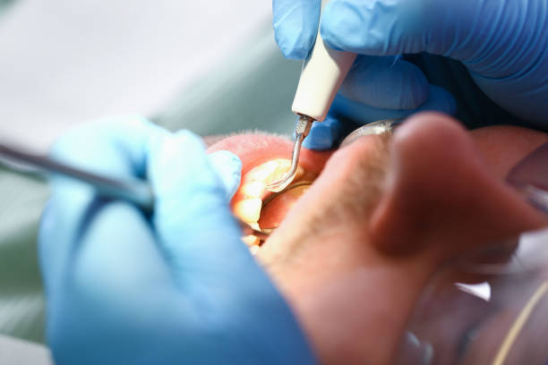 Best Emergency Cosmetic Dentistry (e.g., broken veneers) in Northchase, NC
